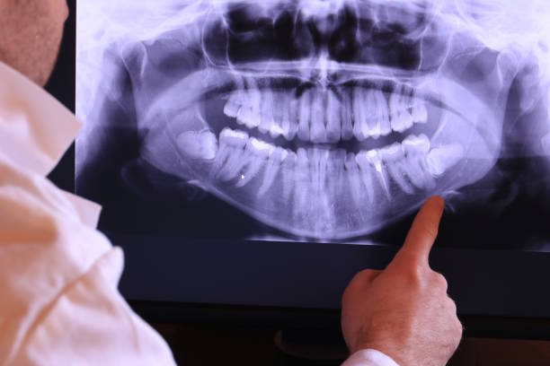 Best Emergency Dental Extractions in Oak Point, TX