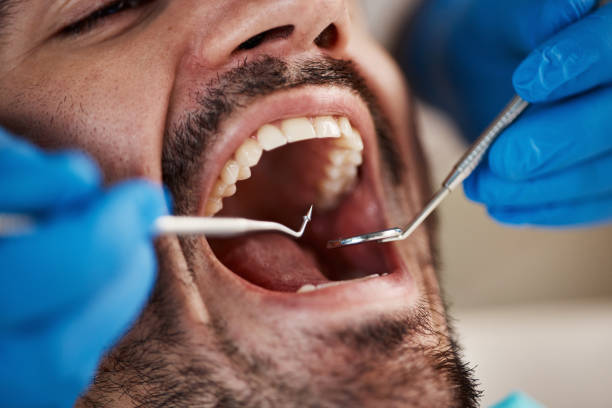 Best Emergency Dental Extractions in Oak Point, TX